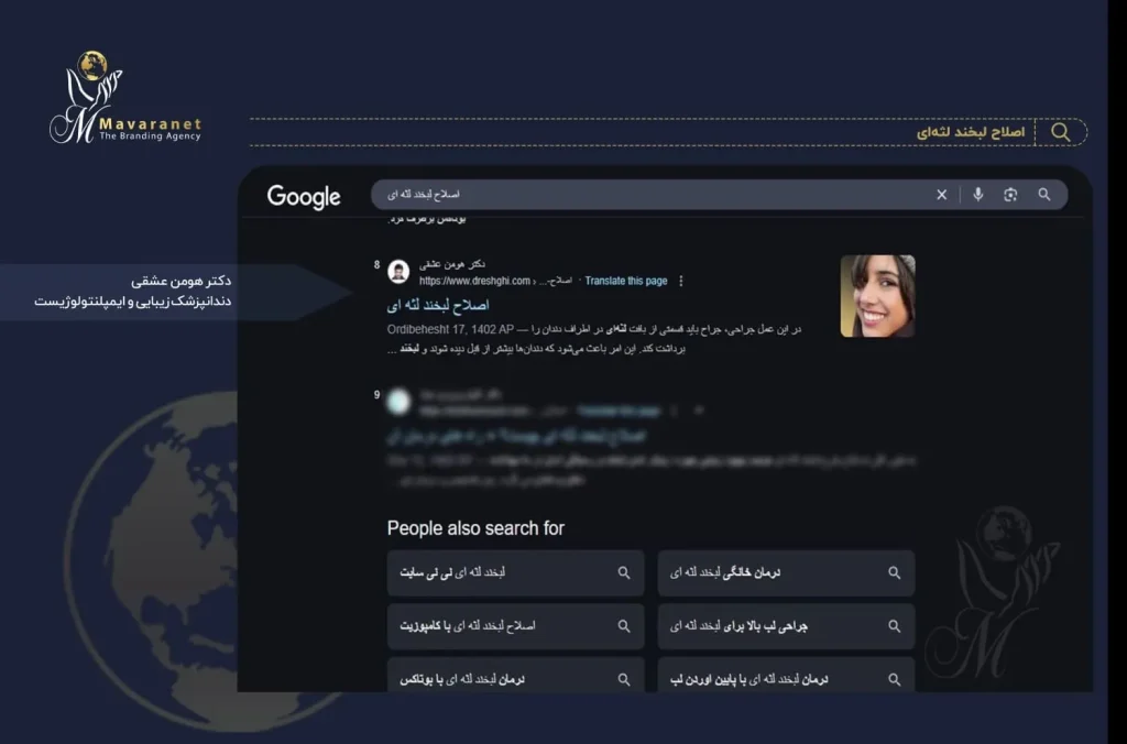 سئو کلمه اصلاح لبخند لثه ای