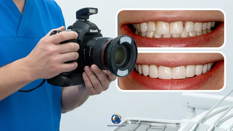 عکاسی در دندانپرشکی