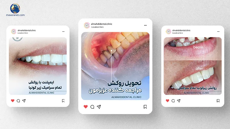 تولید محتوا برای پیج دندانپزشکان