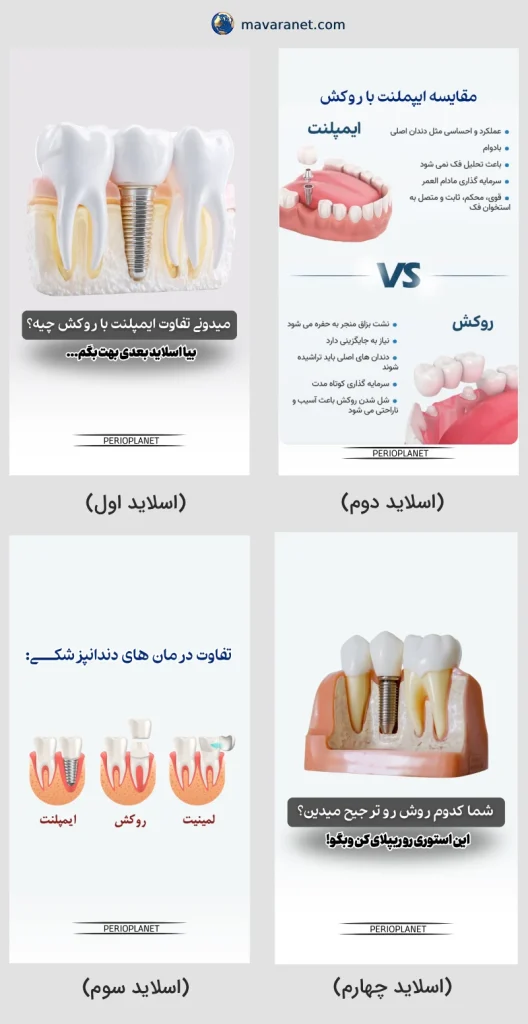 نمونه استوری دندانپزشکی